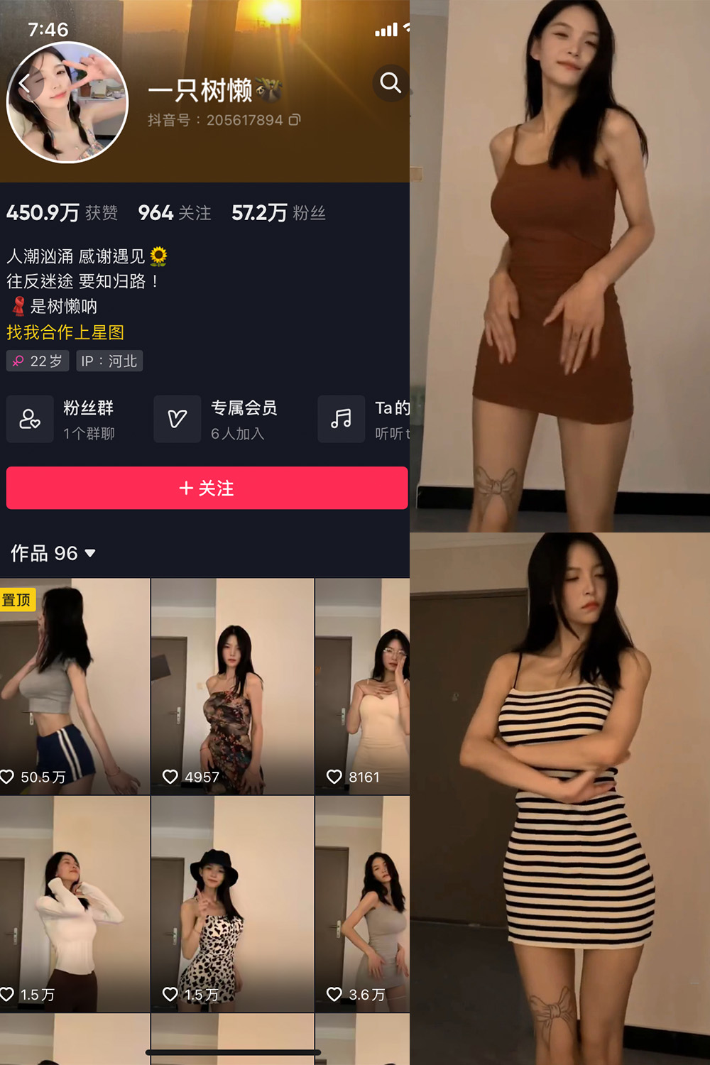 抖音网红 一只树懒 微密圈 NO.004期 【21P10V】